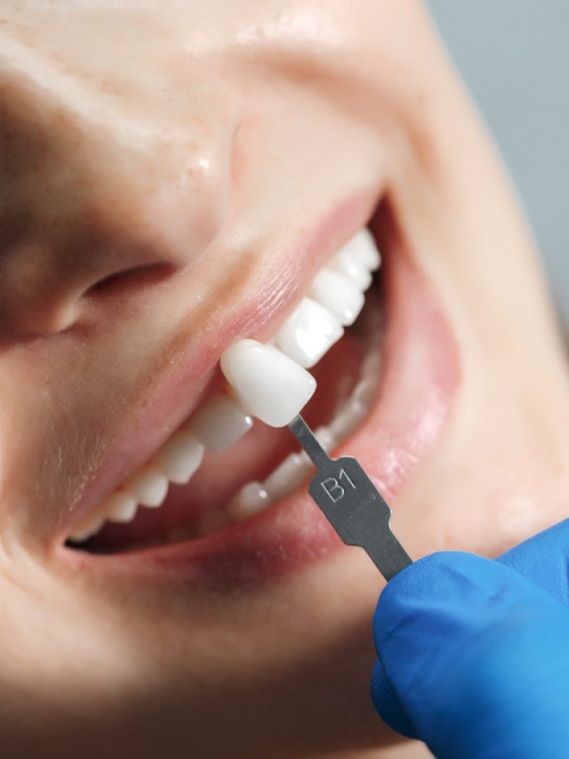 Replace missing teeth with dental implants in greater St. George and southwestern Utah!